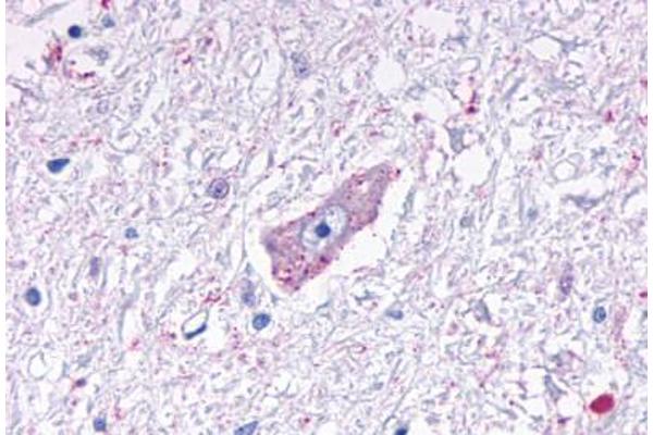 MRGPRD antibody  (Cytoplasmic Domain)