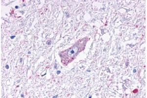 Anti-MRGPRD antibody  ABIN1049070 IHC staining of human brain, medulla. (MRGPRD antibody  (Cytoplasmic Domain))
