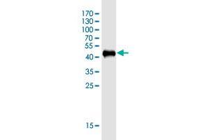 Western Blot detection against Immunogen (43. (KIAA1143 antibody  (AA 1-154))