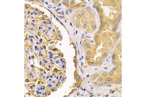 Immunohistochemistry of paraffin-embedded human kidney using USO1 antibody (ABIN5971479) at dilution of 1/200 (40x lens).