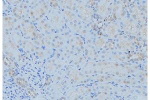 ABIN6279361 at 1/100 staining Mouse kidney tissue by IHC-P. (POLG antibody  (Internal Region))