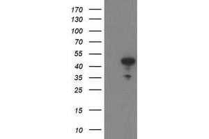 HEK293T cells were transfected with the pCMV6-ENTRY control (Left lane) or pCMV6-ENTRY ACY1 (Right lane) cDNA for 48 hrs and lysed. (Aminoacylase 1 antibody)