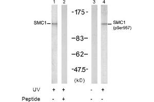 Image no. 2 for anti-Structural Maintenance of Chromosomes 1A (SMC1A) (Ser957) antibody (ABIN197408) (SMC1A antibody  (Ser957))