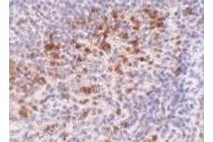 Immunohistochemistry of Catheli-cidin in human spleen tissue with Cathelicidin antibody at 5 μg/ml. (Cathelicidin antibody  (C-Term))