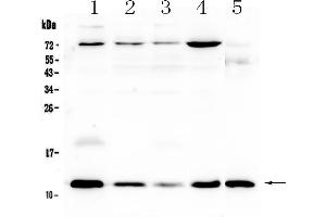 Western blot analysis of DYNLT1 using anti-DYNLT1 antibody . (DYNLT1 antibody  (AA 1-80))