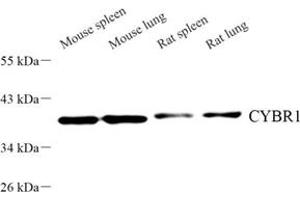 Western blot analysis of CYBR1 (ABIN7073658) at dilution of 1: 500