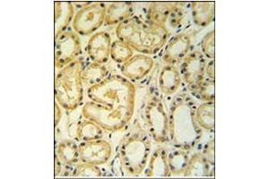 Immunohistochemistry analysis in Formalin Fixed, Paraffin Embedded Human lung tissue using RT25 antibody (C-term) followed by peroxidase conjugation of the secondary antibody and DAB staining.