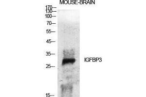 Western Blot (WB) analysis of specific cells using IGFBP3 Polyclonal Antibody. (IGFBP3 antibody  (Ser53))