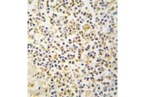 Image no. 2 for anti-Aldehyde Dehydrogenase 1 Family, Member A3 (ALDH1A3) (N-Term) antibody (ABIN360200) (ALDH1A3 antibody  (N-Term))