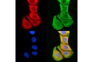 ABIN6259425 and ABIN6276230 staining Hela cells(30 min of UV treatment) by IF/ICC. (TMEM145 antibody  (N-Term))