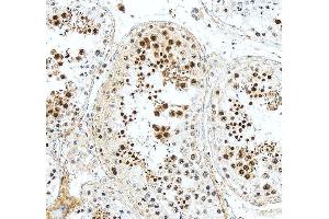 IHC analysis of DAZAP1 using anti-DAZAP1 antibody (ABIN6719309).