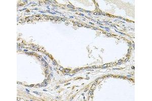 Immunohistochemistry of paraffin-embedded Human prostate using TNFRSF10A Polyclonal Antibody at dilution of 1:100 (40x lens). (TNFRSF10A antibody)