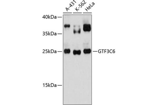 GTF3C6 抗体  (AA 1-213)