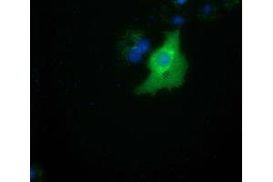 Anti-SMAD2 mouse monoclonal antibody (ABIN2453655) immunofluorescent staining of COS7 cells transiently transfected by pCMV6-ENTRY SMAD2 (RC204604). (SMAD2 antibody)