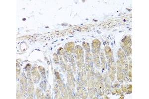 Immunohistochemistry of paraffin-embedded Mouse stomach using IRS2 Polyclonal Antibody at dilution of 1:100 (40x lens). (IRS2 antibody)
