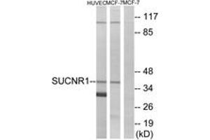 Western blot analysis of extracts from HuvEc/MCF-7 cells, using SUCNR1 Antibody. (SUCNR1 antibody  (AA 100-149))