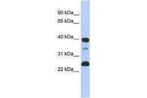 WB Suggested Anti-TMPO  Antibody Titration: 0. (Thymopoietin antibody  (N-Term))