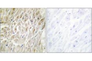 Immunohistochemistry analysis of paraffin-embedded human heart tissue, using DLX3 Antibody.