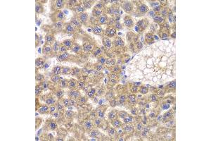 Immunohistochemistry of paraffin-embedded rat liver using FASTK antibody (ABIN5974251) at dilution of 1/100 (40x lens). (FASTK antibody)