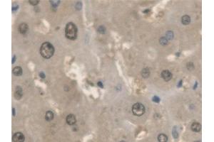 ANTXR2 antibody  (AA 34-318)