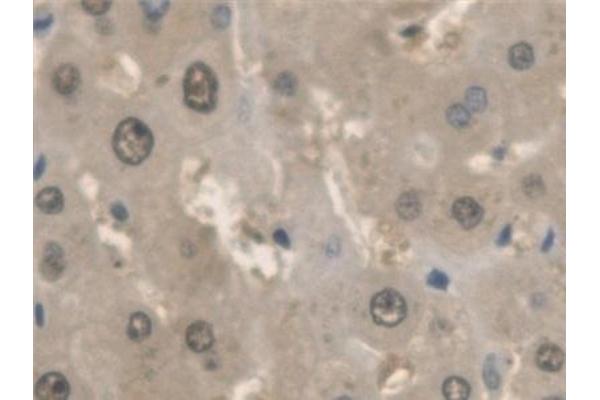 ANTXR2 antibody  (AA 34-318)