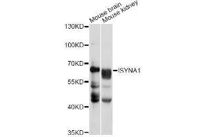 Western blot analysis of extracts of various cell lines, using ISYNA1 antibody (ABIN5996670) at 1/1000 dilution.