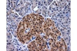 Immunohistochemical staining of paraffin-embedded Kidney tissue using anti-RC219453 mouse monoclonal antibody. (NPR3 antibody)