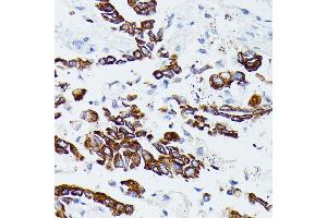 Immunohistochemistry (IHC) image for anti-Matrix Metallopeptidase 25 (MMP25) (AA 350-540) antibody (ABIN7268422)