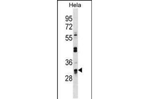 Western blot analysis in Hela cell line lysates (35ug/lane). (UTP11L antibody  (C-Term))