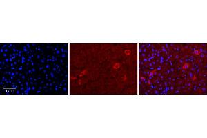 Rabbit Anti-TUSC4 Antibody      Formalin Fixed Paraffin Embedded Tissue: Human Adult Liver   Observed Staining: Cytoplasm in hepatocytes, moderate signal, very low tissue distribution  Primary Antibody Concentration: 1:100  Secondary Antibody: Donkey anti-Rabbit-Cy3  Secondary Antibody Concentration: 1:200  Magnification: 20X  Exposure Time: 0. (NPRL2 antibody  (N-Term))