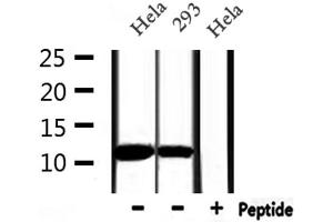 Western blot analysis of extracts from Hela and 293, using MIF Antibody. (MIF antibody  (C-Term))