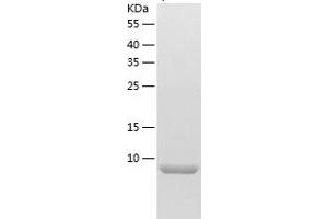 Western Blotting (WB) image for Chemokine (C-C Motif) Ligand 14 (CCL14) (AA 28-93) protein (His tag) (ABIN7287352) (CCL14 Protein (AA 28-93) (His tag))