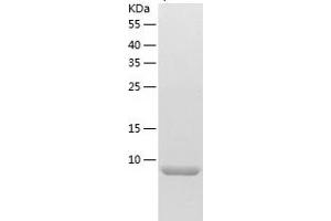Western Blotting (WB) image for Chemokine (C-C Motif) Ligand 14 (CCL14) (AA 28-93) protein (His tag) (ABIN7122267)