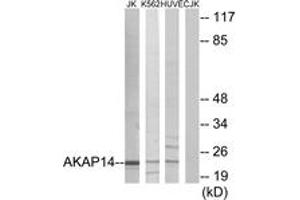Western Blotting (WB) image for anti-A Kinase (PRKA) Anchor Protein 14 (AKAP14) (AA 1-50) antibody (ABIN2889659) (AKAP14 antibody  (AA 1-50))