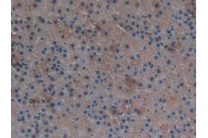 Detection of TXNRD1 in Rat Adrenal gland Tissue using Polyclonal Antibody to Thioredoxin Reductase 1 (TXNRD1) (TXNRD1 antibody  (AA 208-433))