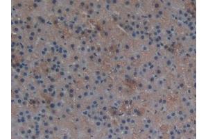 Detection of TXNRD1 in Rat Adrenal gland Tissue using Polyclonal Antibody to Thioredoxin Reductase 1 (TXNRD1)