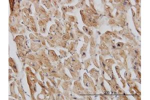 Image no. 1 for anti-Eukaryotic Translation Initiation Factor 4 gamma 2 (EIF4G2) (AA 811-890) antibody (ABIN598656) (EIF4G2 antibody  (AA 811-890))