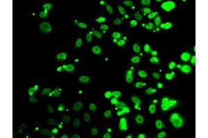Immunofluorescence analysis of A549 cells using FIP1L1 antibody (ABIN5974293). (FIP1L1 antibody)