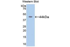 Western Blotting (WB) image for anti-Matrix Metallopeptidase 8 (Neutrophil Collagenase) (MMP8) (AA 101-467) antibody (ABIN1078309) (MMP8 antibody  (AA 101-467))