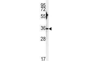Western Blotting (WB) image for anti-Carbonic Anhydrase III (CA3) antibody (ABIN3003364)