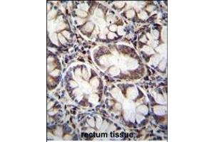 Immunohistochemistry (Paraffin-embedded Sections) (IHC (p)) image for anti-Calcium Channel, Voltage-Dependent, gamma Subunit 8 (CACNG8) (AA 90-119), (N-Term) antibody (ABIN655566)