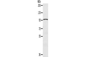 Western Blotting (WB) image for anti-CDKN1A Interacting Zinc Finger Protein 1 (CIZ1) antibody (ABIN2435266) (CIZ1 antibody)