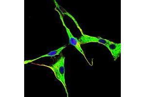 Immunofluorescence (IF) image for anti-Adrenergic, Beta, Receptor Kinase 1 (ADRBK1) antibody (ABIN969178)