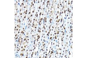 Immunohistochemistry of paraffin-embedded mouse stomach using FOX Rabbit pAb (5278) at dilution of 1:100 (40x lens). (FOXA1 antibody  (AA 263-472))