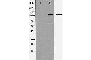 Western blot analysis of Integrin αV expression in HeLa cells,The lane on the left is treated with the antigen-specific peptide. (CD51 antibody  (Internal Region))