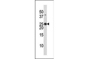 The anti-Phospho-Bad- Pab (ABIN389519 and ABIN2839570) is used in Western blot to detect Phospho-Bad- in HL60 tissue lysate (BAD antibody  (pSer134))