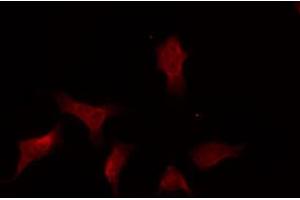 ABIN6269332 staining A431 by IF/ICC. (PTPN11 antibody  (C-Term))
