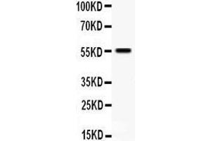 Anti- TFPI antibody, Western blotting All lanes: Anti TFPI  at 0. (TFPI antibody  (N-Term))