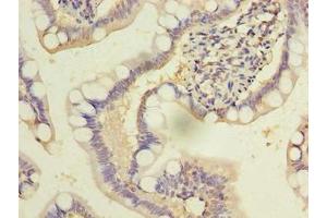 Immunohistochemistry of paraffin-embedded human small intestine tissue using ABIN7149679 at dilution of 1:100 (DENND2D antibody  (AA 1-233))