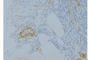 ABIN6275032 at 1/100 staining Human uterus tissue by IHC-P. (C1S antibody  (C-Term))